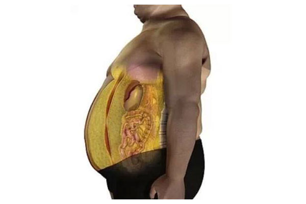 过多的内脏脂肪危害大快为内脏减减肥