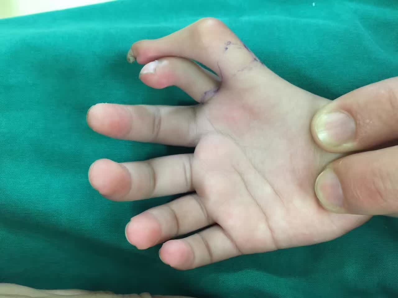 擅長：顏面骨外傷及面部輪廓整復、鼻唇畸形整復、手部燒創傷急救及先天后遺畸形治療與功能重...號販子掛號,圈子口碑最好100%有號用實力辦事，方便每一位患者的簡單介紹