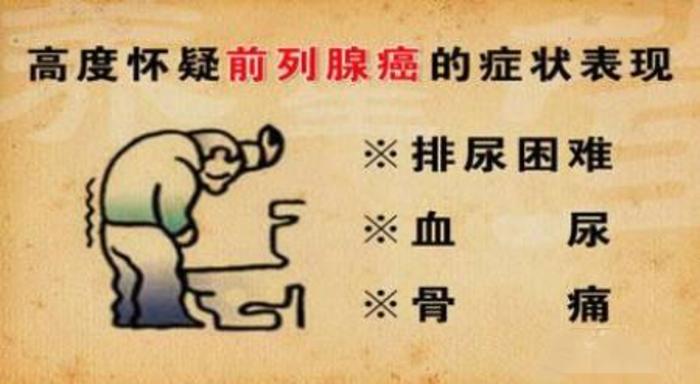 早期的前列腺癌没有明显的症状.仅仅表现为尿频,尿急,夜尿增多.