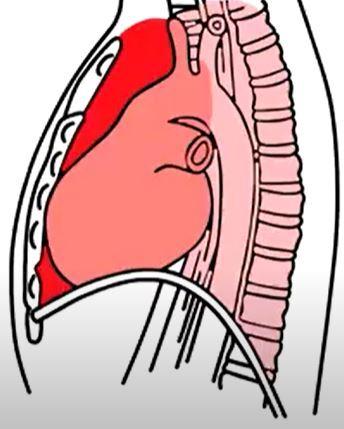 纵隔的分区纵隔内有心脏,大血管,食管,气管,神经,胸腺,胸导管,丰富的