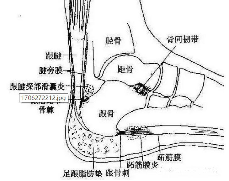 脚筋 人体解剖图图片