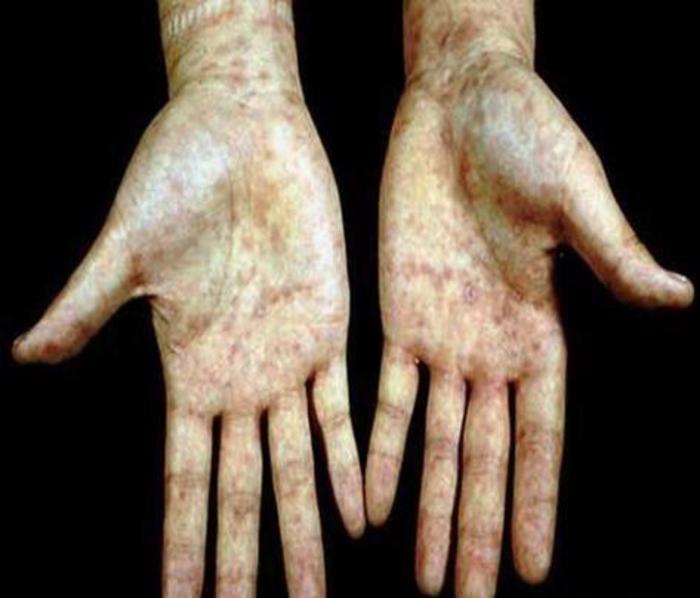 大保健后你忧虑吗? - 微医(挂号网)