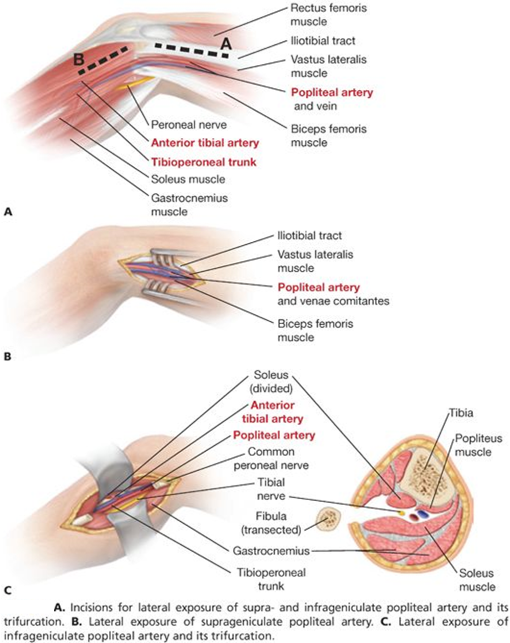 图文解码腘动脉陷迫综合征(paes)