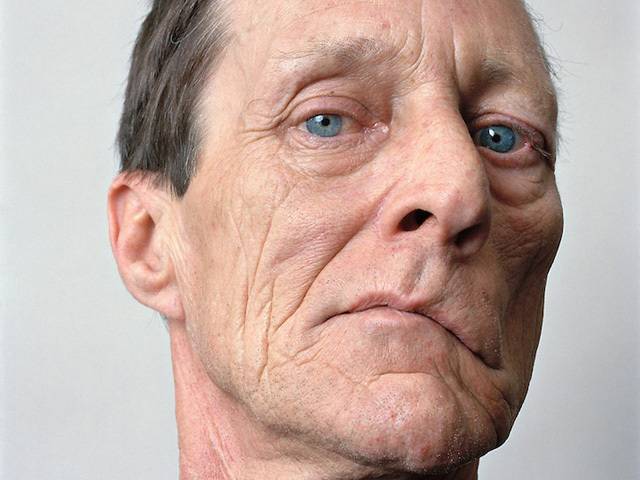 夏天吹空调风扇真的会招致面瘫吗