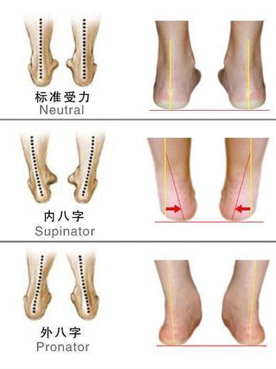 家长警惕小孩走路容易疲劳小心是扁平足惹的祸