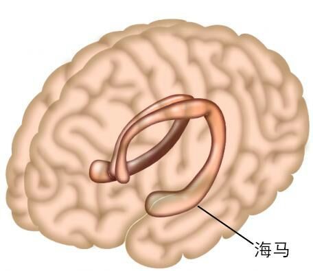 颞叶癫痫不可拖延治疗,术后患者再治疗首先需定位癫痫灶 - 微医(挂号