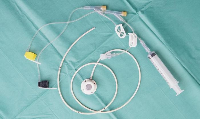 化疗丨可以带着游泳洗澡的化疗置管——静脉输液港