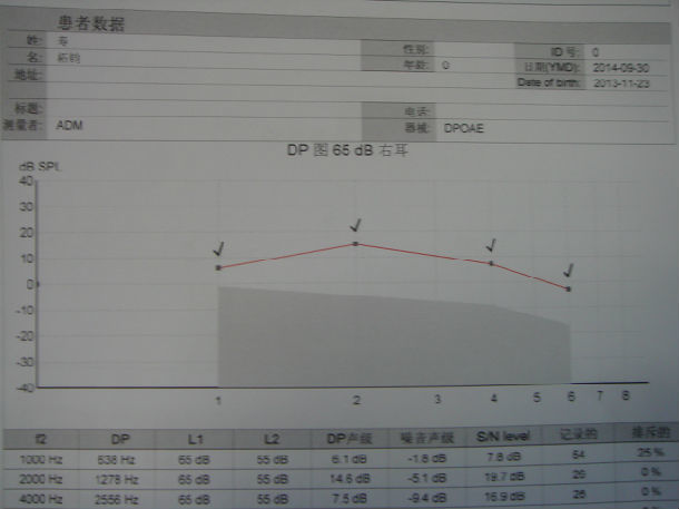 小兒缺鐵性聾早期治療可以恢復正常聽力