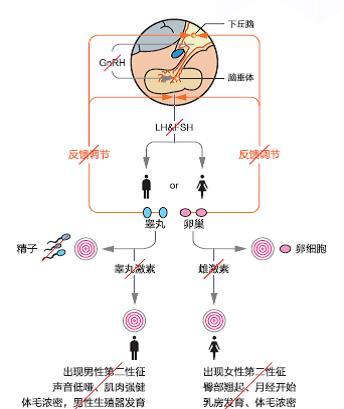 有嗅觉受损者称为卡尔曼综合征(kallmann syndrome,ks);嗅觉正常者,称