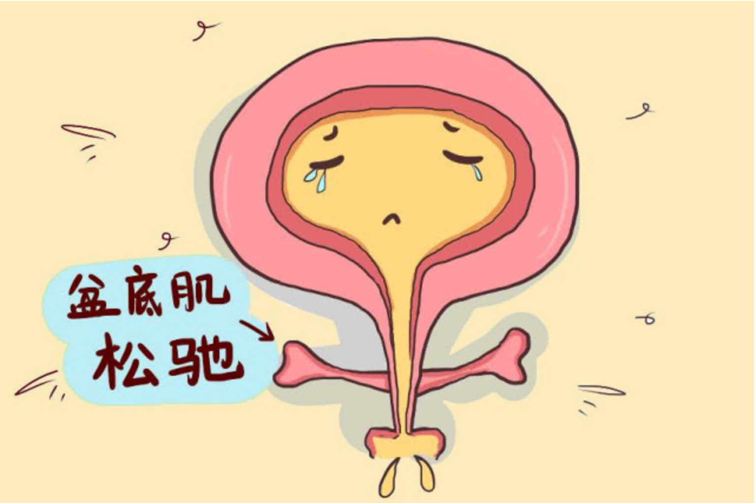 咳嗽一下就漏尿到底是怎么回事
