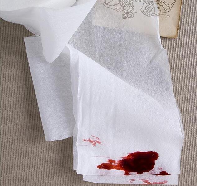 痔疮患者也会出现大便带血的情况,但是和大肠癌出血是有区别的.