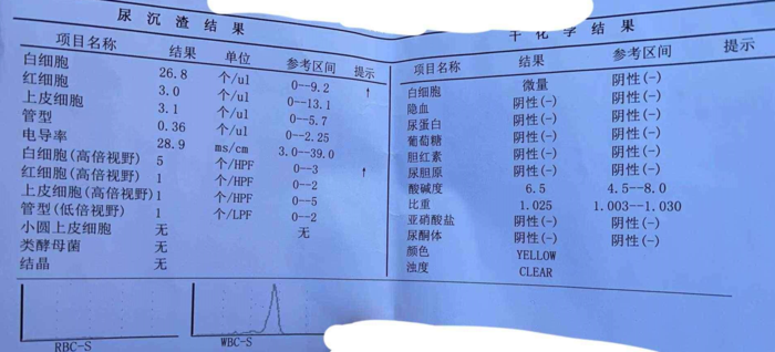 男生尿道口流膿加白細胞高就能確定是淋病了嗎