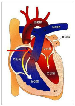 肺高压动脉症状及表现_肺动脉高压症状_肺高压动脉怎么形成的