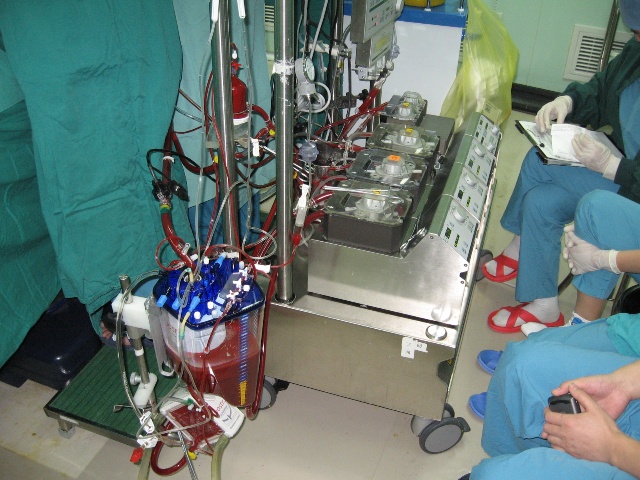 心血管外科的支撑伙伴体外循环