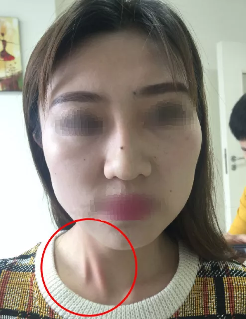 脸部不对称还需注意斜颈问题