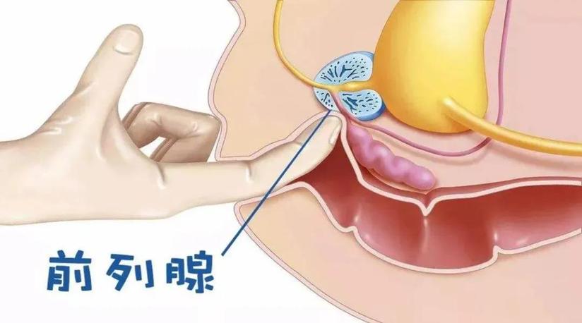 前列无忧 前列腺 尿道球腺 深度 按摩治疗 健康号 微医