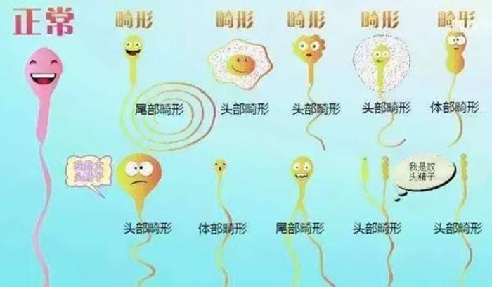 精子形态分析正常形态率标准是多少？_健康号-微医
