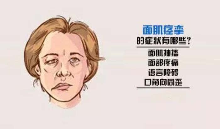 面肌痉挛是什么原因引起的呢