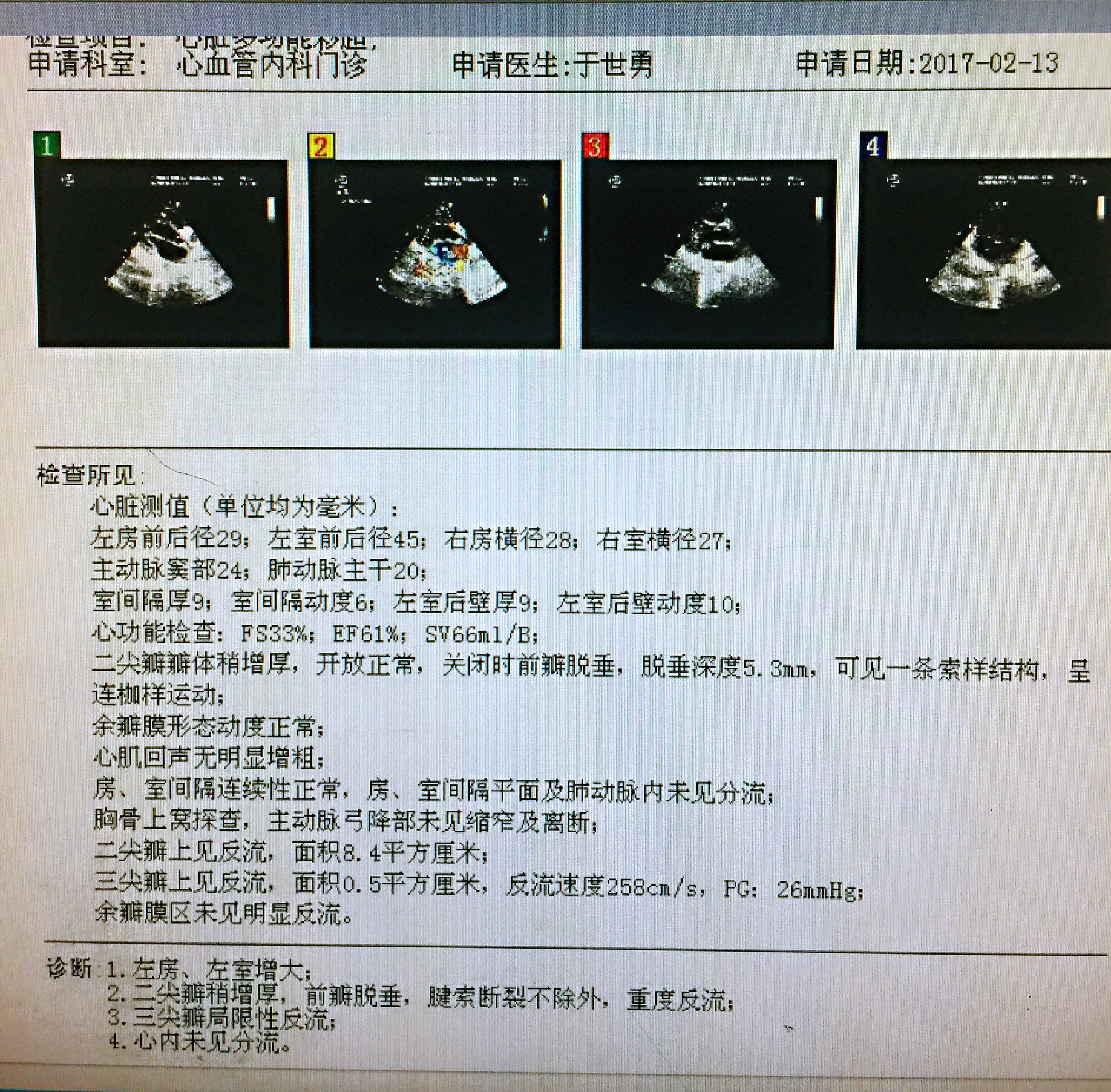 二尖瓣关闭不全是直接换瓣还是先考虑成形修复