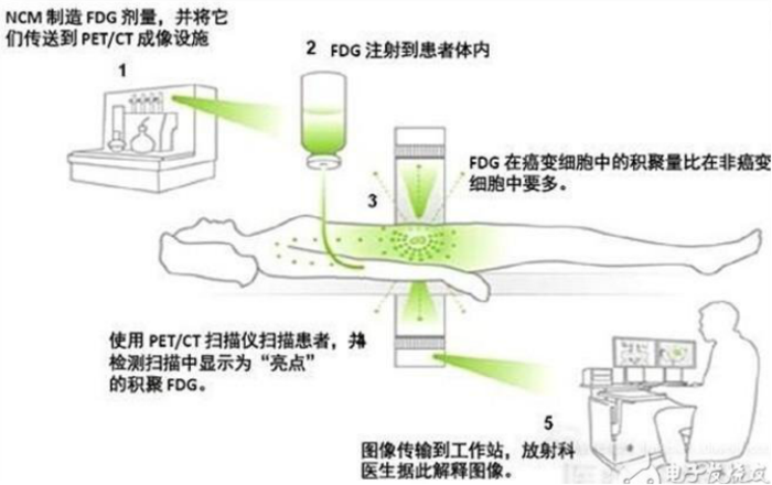听说pet/ct(派特)辐射很大,是真的吗? - 微医(挂号网)