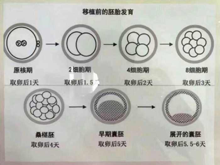 囊胚移植是什么