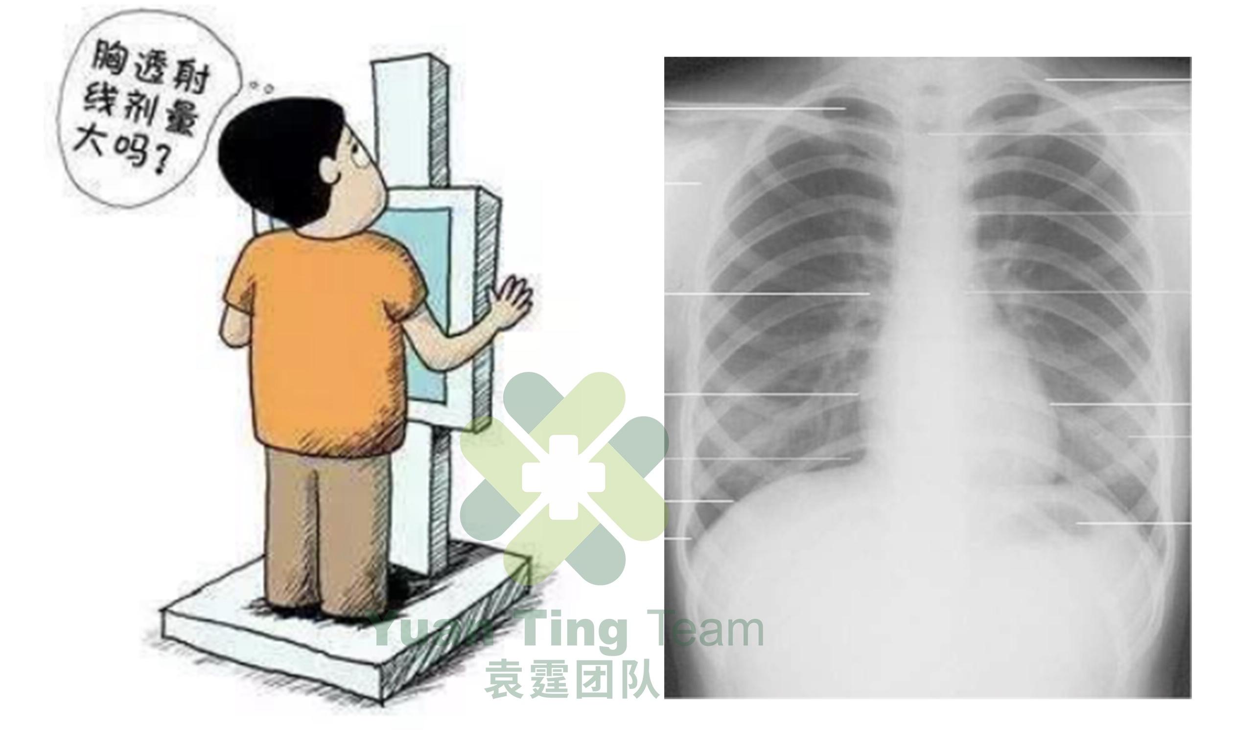 每年体检拍胸片真的会致癌吗