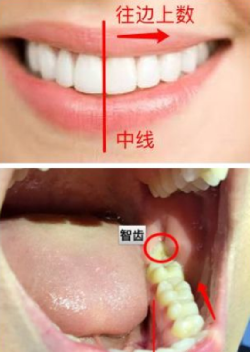 牙齿上火疼痛 这情况要拔牙 健康号 微医