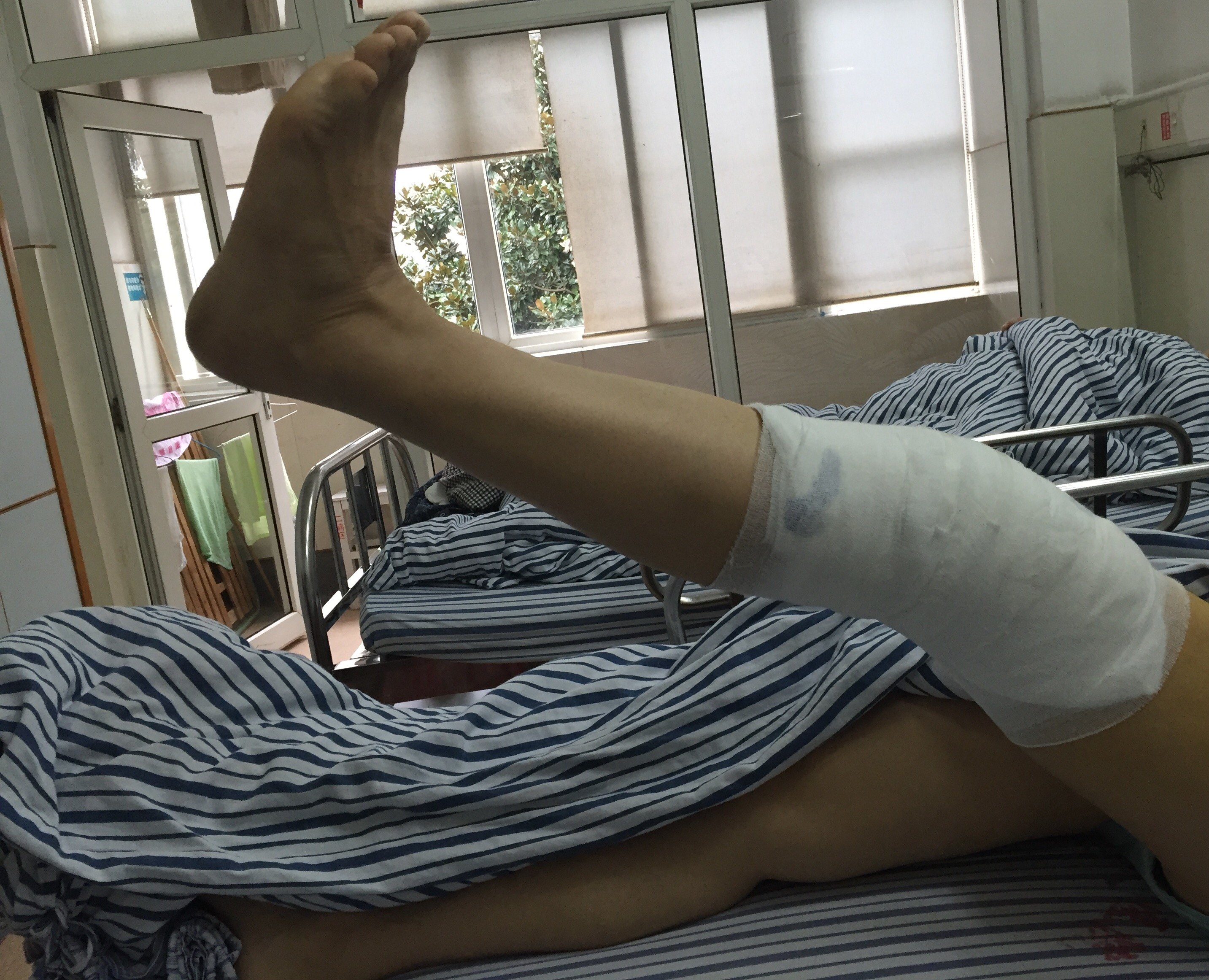 膝前后交叉韧带重建术患者康复步骤