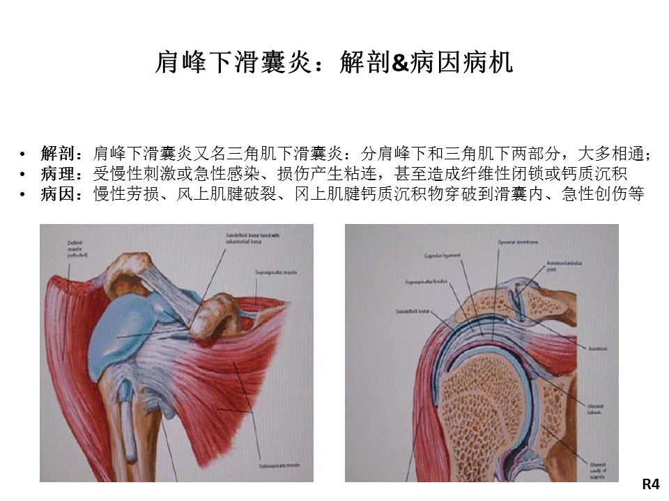 香港关节超声中级班听课笔记肩关节扫描及超声引导下穿刺