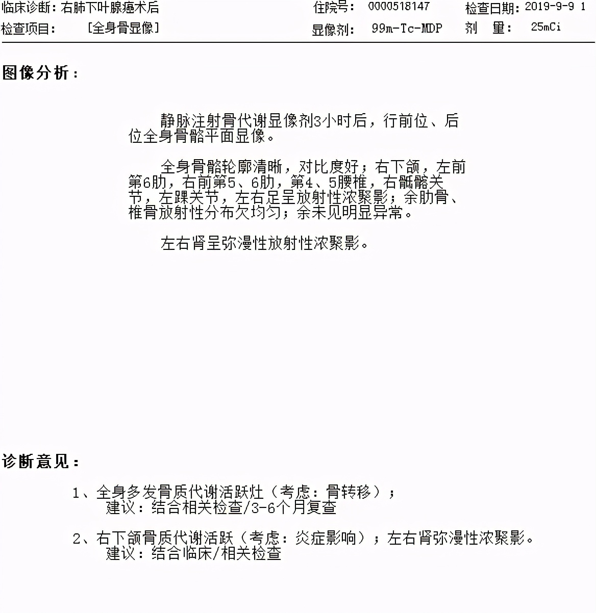 肺腺癌骨转移系列之1重磅原创首例中医药治愈肺腺癌多发骨转移