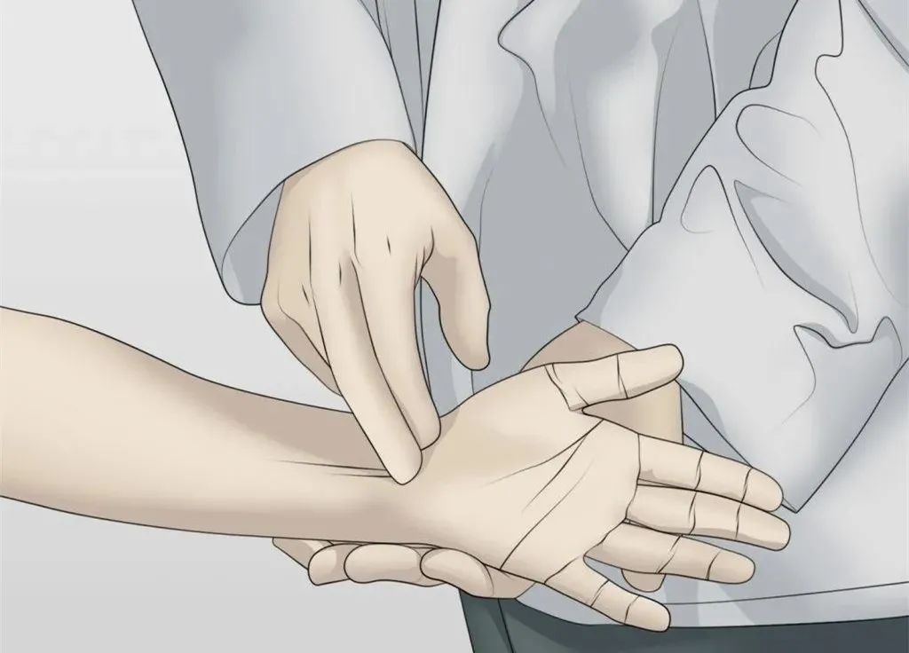 phalen征(屈腕试验)阳性--极度屈腕并用力握拳1分钟,出现手部感觉异常