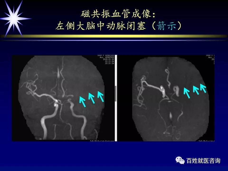核磁共振要脱内衣吗(2)