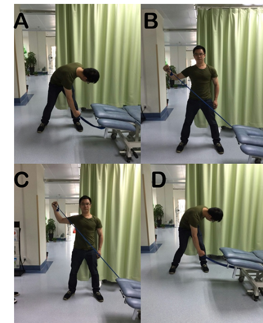 科学运动治疗肩峰撞击征