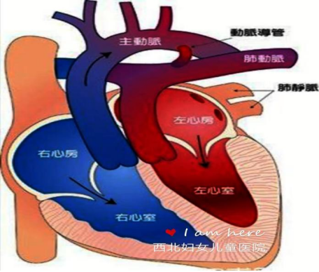 大动脉转位解剖图图片