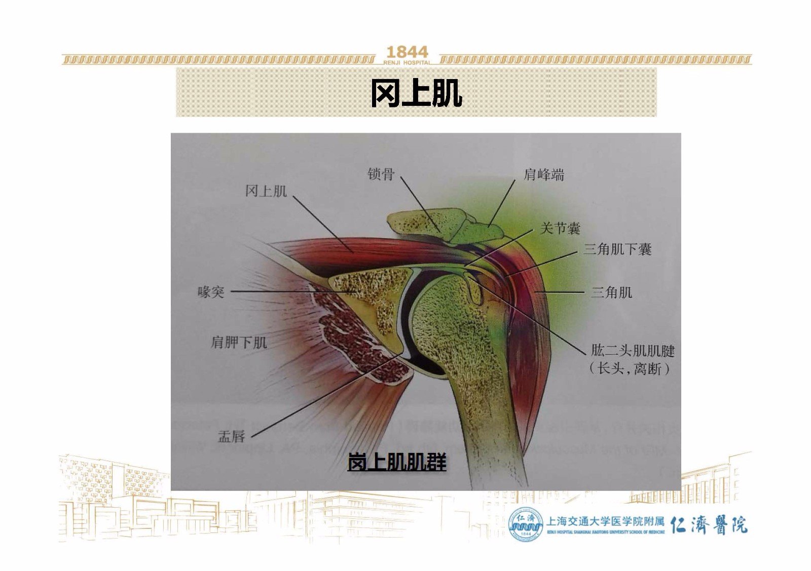 右肩冈上肌腱撕裂图片图片