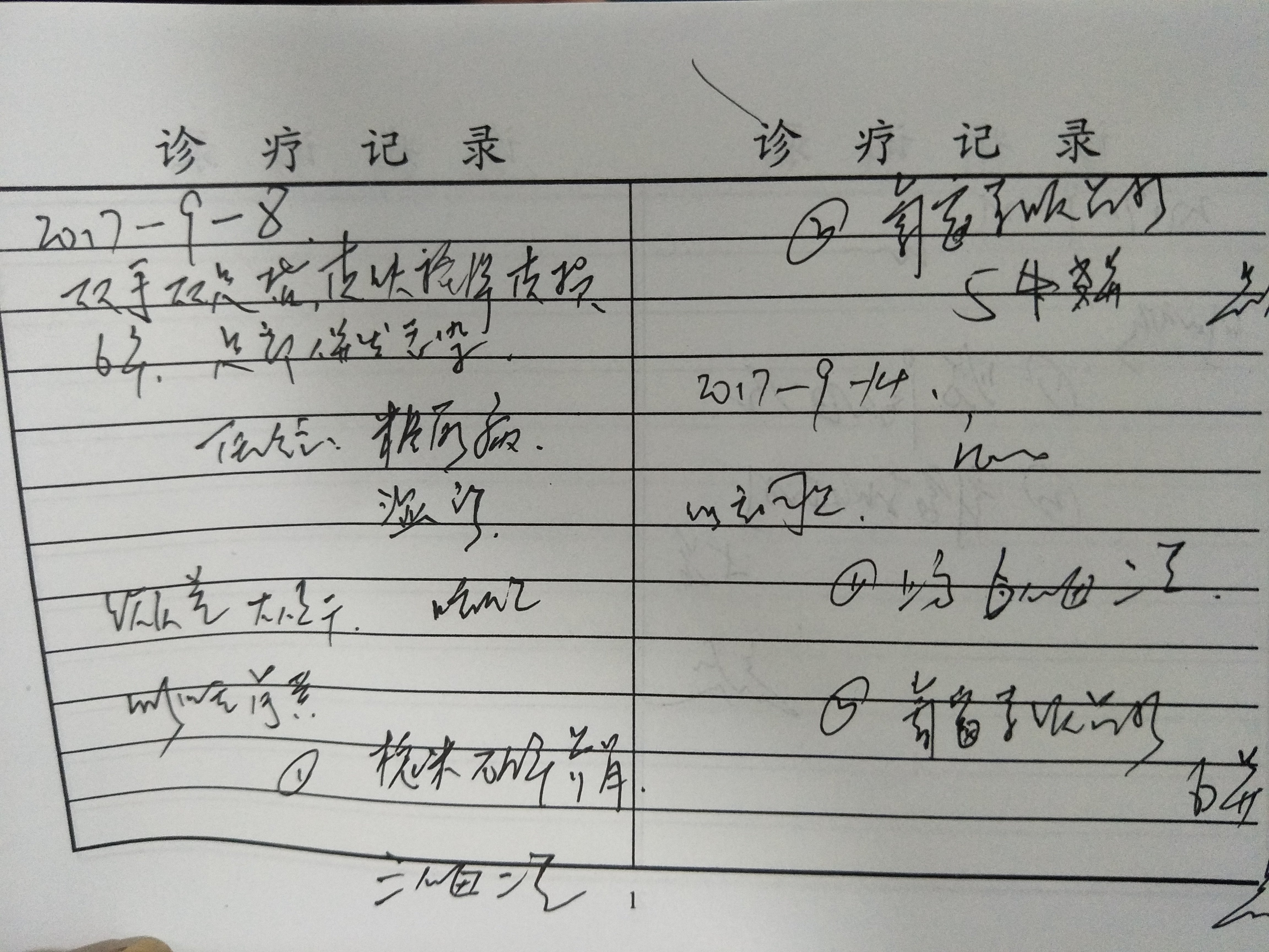 中医治疗湿疹案例分享