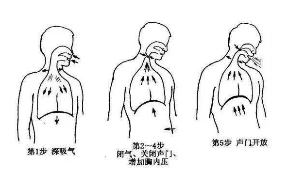肺癌术后患者如何做好呼吸操