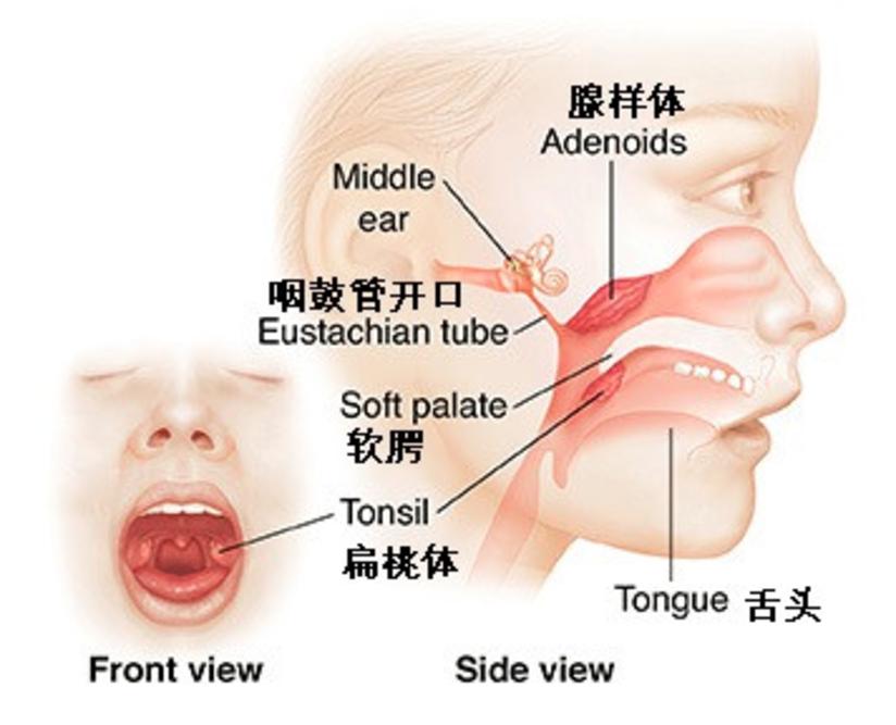 腺样体肥大，保守还是手术？看完这个你就都明白了！_健康号-微医