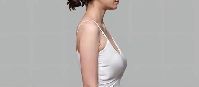 出现下垂的胸部是否还能隆胸