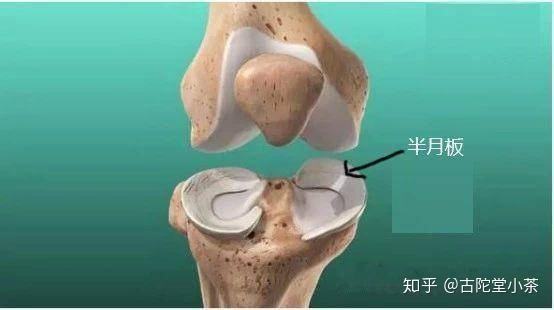 半月板损伤是怎么回事