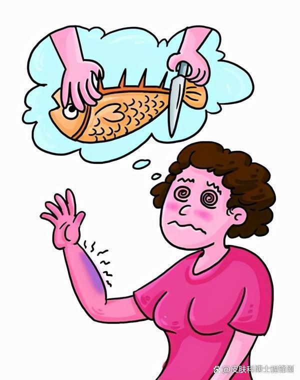 手被鱼骨刺伤,一年辗转难眠_程锋刚医生文章_广州市胸科医院-微医