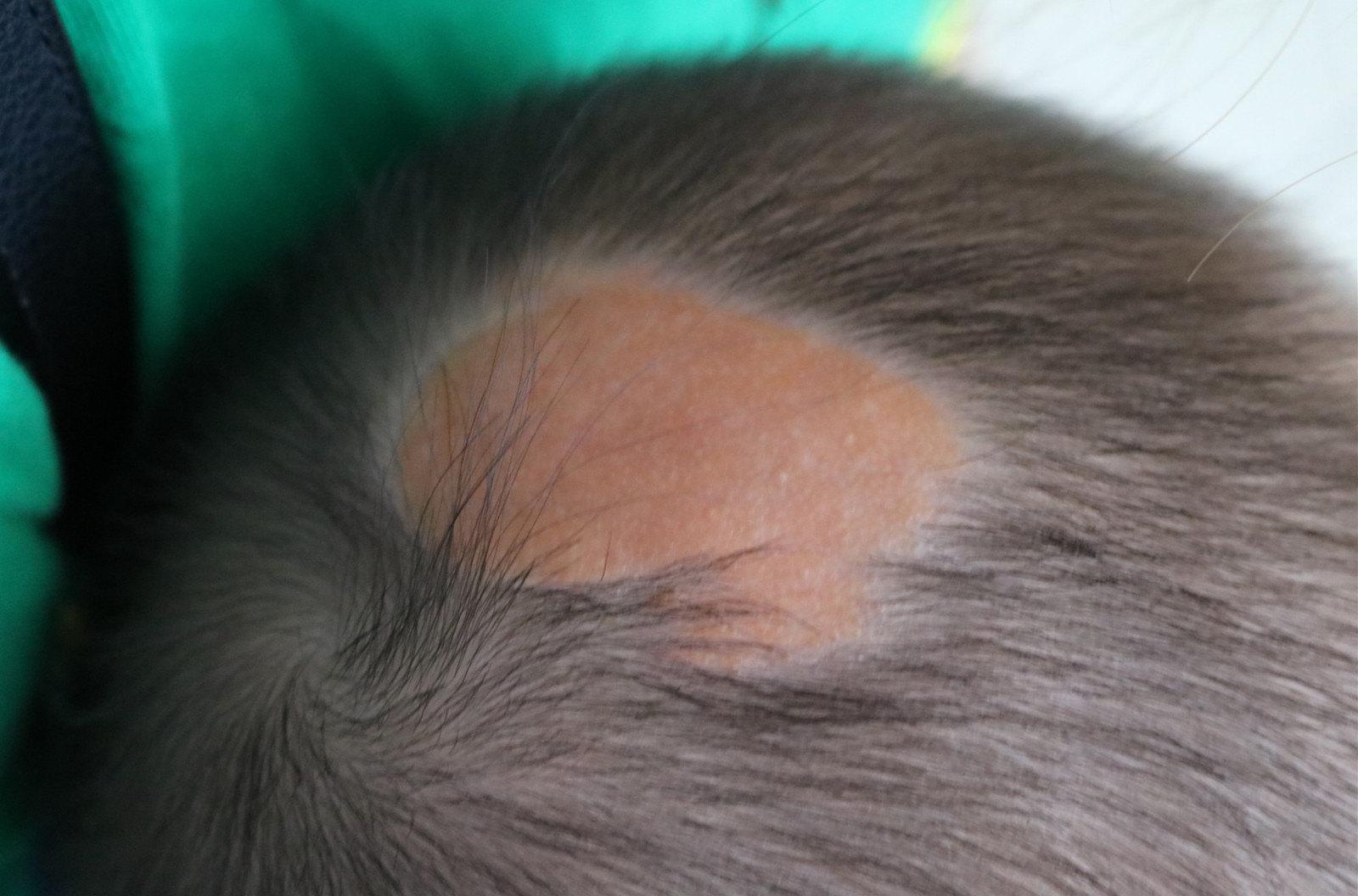 是一种错构瘤病变,主要包括皮脂腺,流产毛囊和异位的大汗腺腺体(多