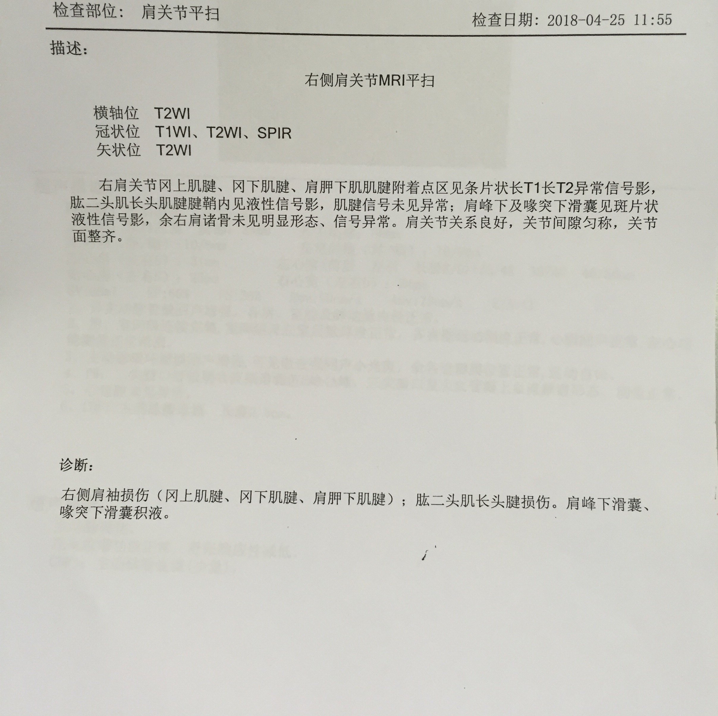 肩周炎痛苦中医正骨来解除