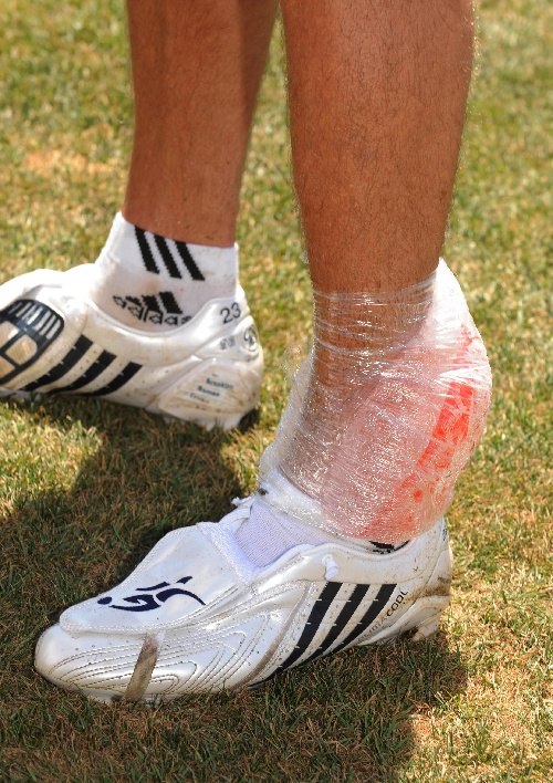 什么是冰敷疗法