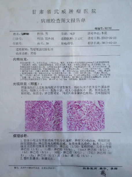 高龄进展期胃癌一例