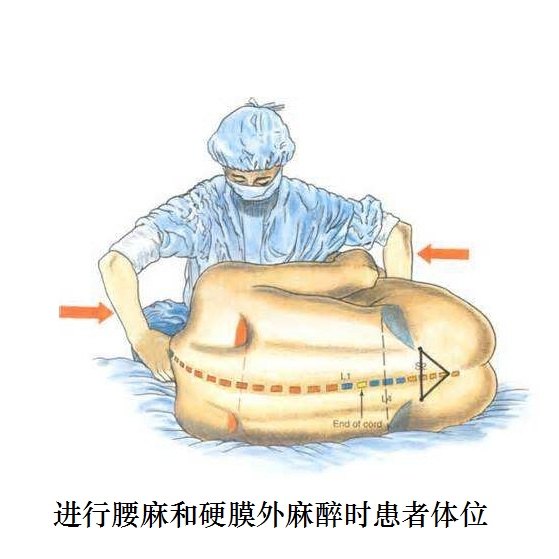 肾结石,输尿管结石微创治疗麻醉必读-微医