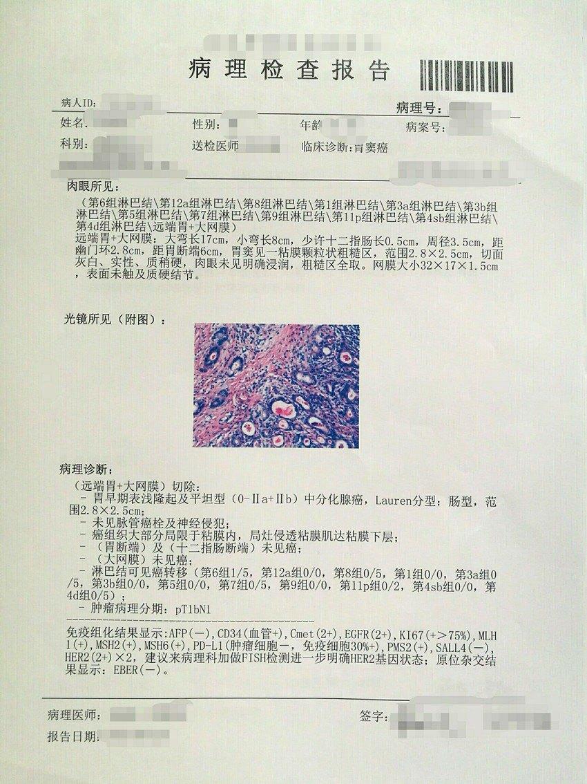 胃癌诊治科普二胃癌术后病理报告单到底说了些啥