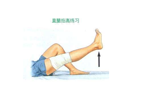 1,股四头肌等张收缩训练直腿抬高锻训练:仰卧位,下肢伸直抬起,保持