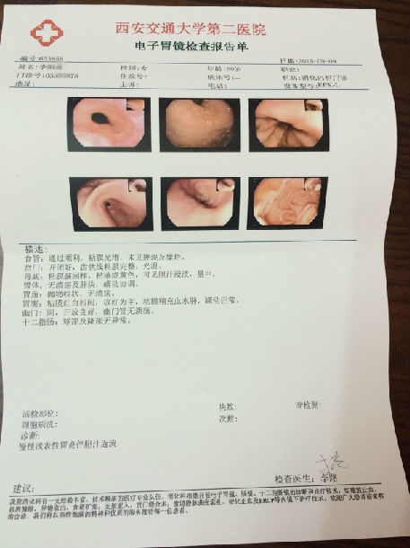 膏方治疗萎缩性胃炎患者的胃镜病理前后对照图片