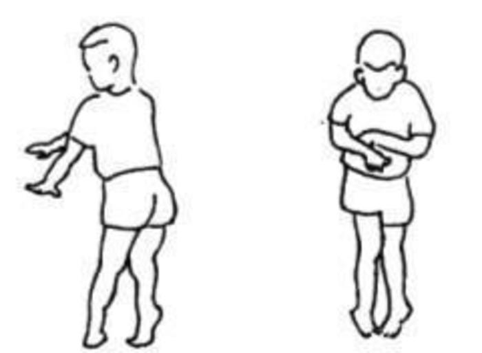 扭转痉挛有什么治疗方法